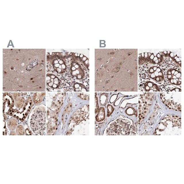 Anti-BUD13 antibody produced in rabbit