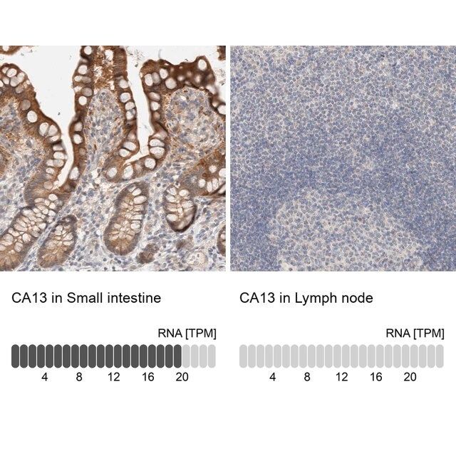 Anti-CA13 antibody produced in rabbit