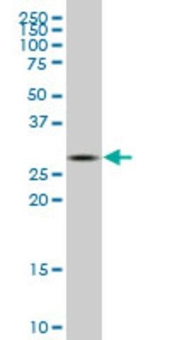 ANTI-CA1 antibody produced in mouse
