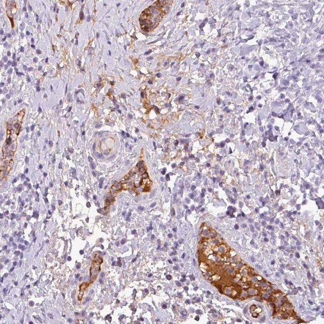 Anti-C4A antibody produced in rabbit