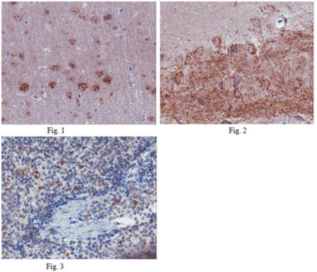 Anti-C-X-C chemokine receptor type 5 (CXCR5) Antibody