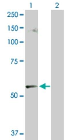 Anti-CABC1 antibody produced in rabbit