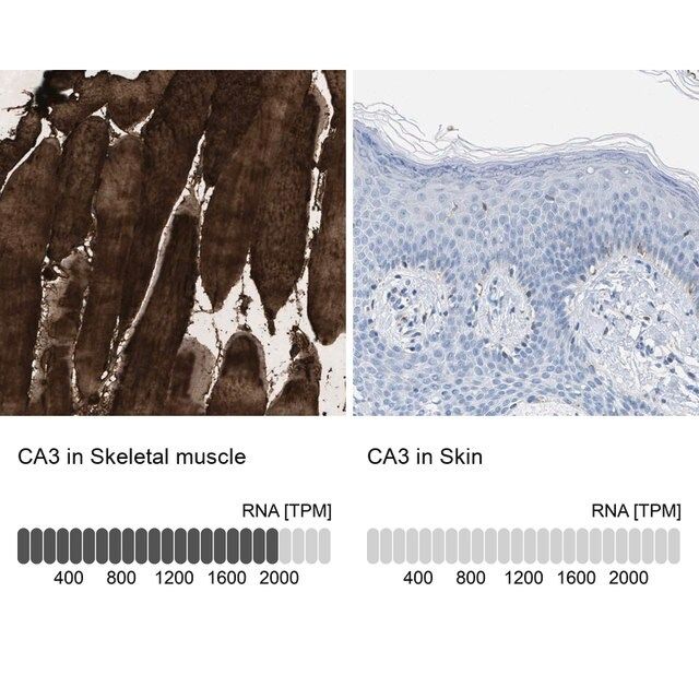 Anti-CA3 antibody produced in rabbit
