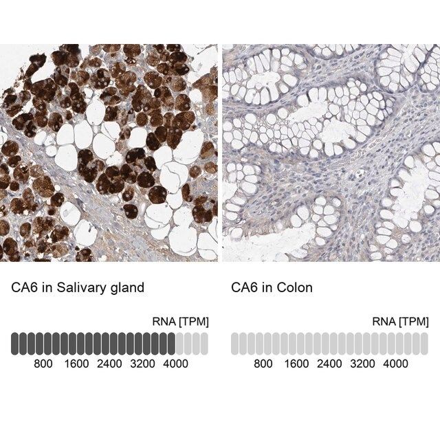 Anti-CA6 antibody produced in rabbit
