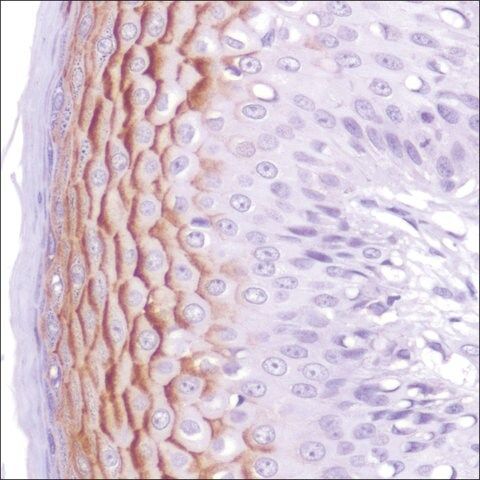 Anti-C4.4A/LYPD3 antibody, Rabbit monoclonal