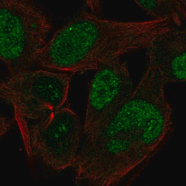 Anti-CABLES1 antibody produced in rabbit
