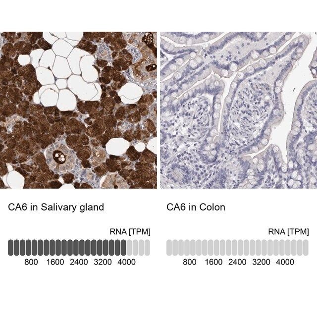 Anti-CA6 antibody produced in rabbit
