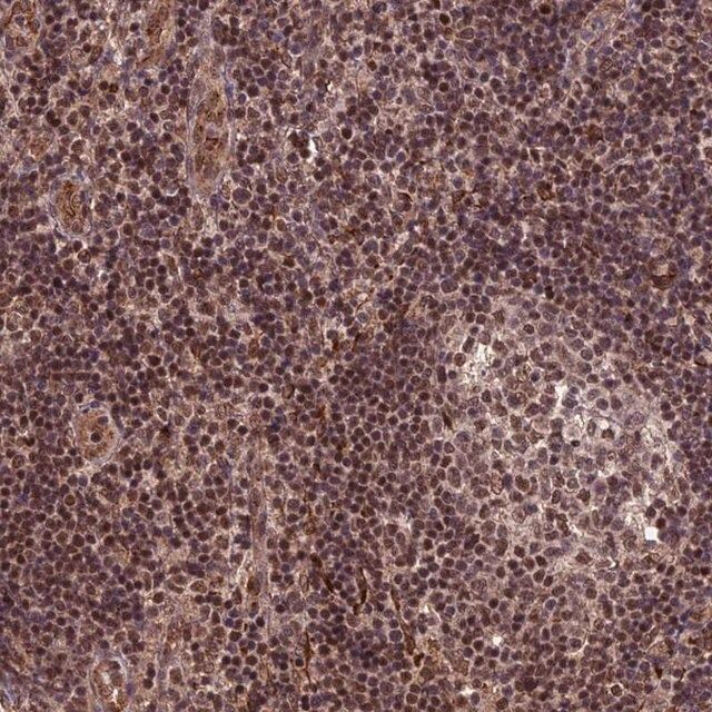 Anti-CABIN1 antibody produced in rabbit