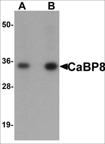 Anti-CaBP8 antibody produced in rabbit