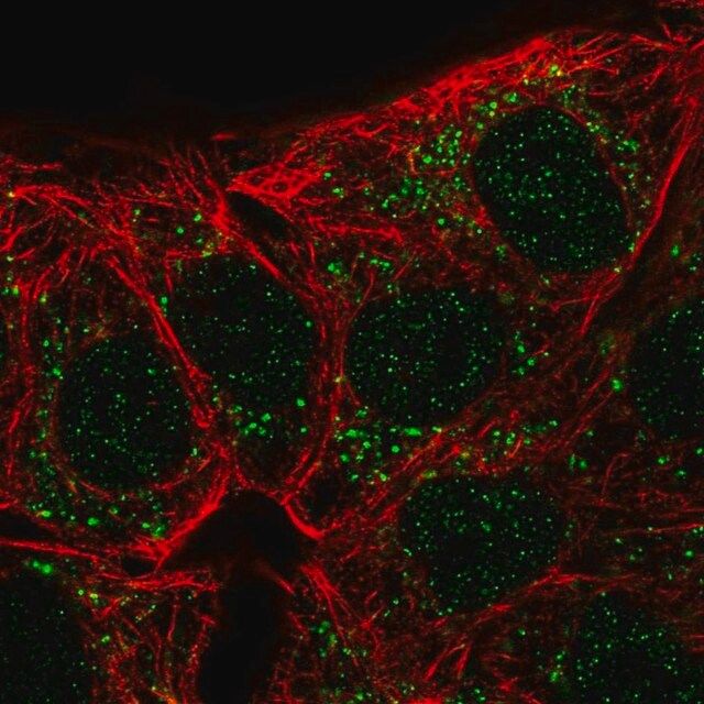 Anti-CA10 antibody produced in rabbit