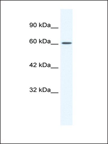 Anti-CACNB2 (ab1) antibody produced in rabbit