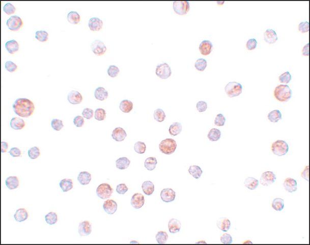 Anti-CABP7 antibody produced in rabbit