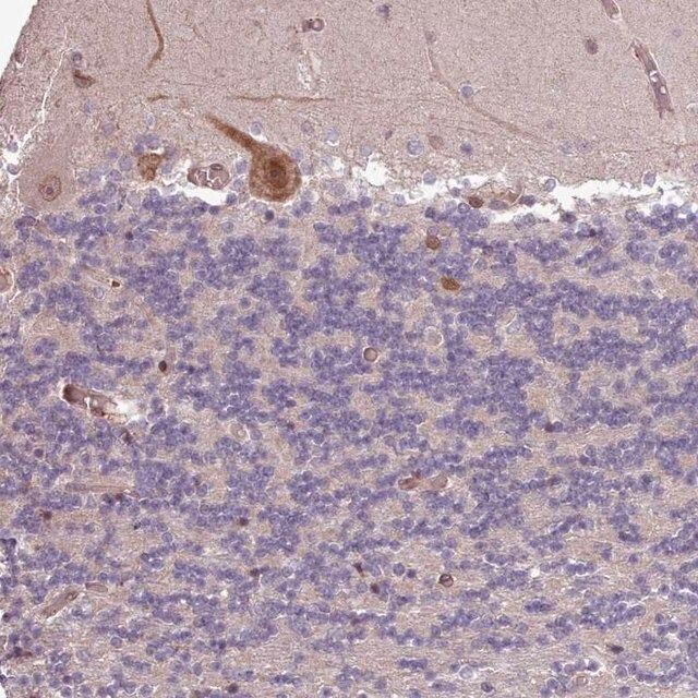 Anti-CABP1 antibody produced in rabbit