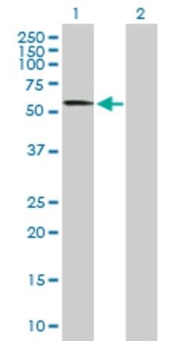Anti-CACNB4 antibody produced in mouse