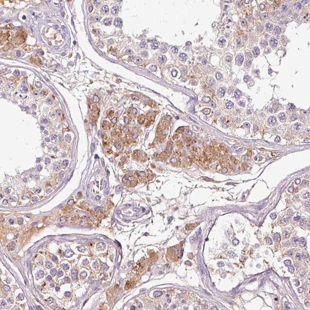 Anti-CAB39L antibody produced in rabbit