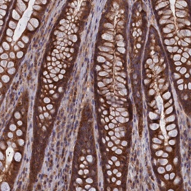 Anti-CACTIN antibody produced in rabbit