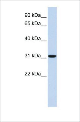Anti-CA8 antibody produced in rabbit
