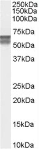 Anti-CACNB4, C-Terminal antibody produced in goat