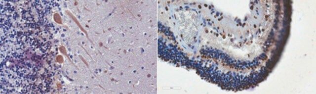 Anti-CaBP1 Antibody, clone 11E7.1