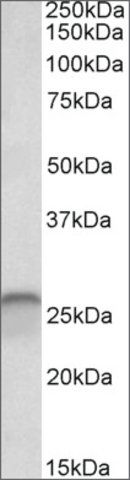 Anti-CALB1 antibody produced in goat