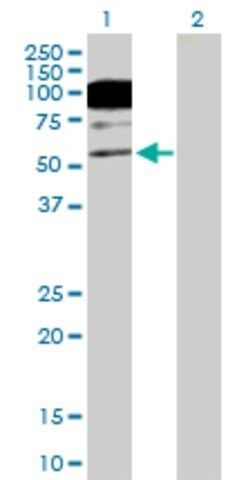Anti-CACNB1 antibody produced in mouse