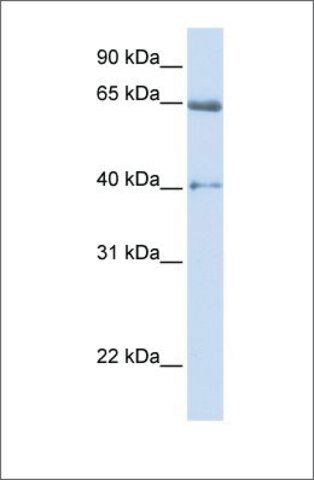 Anti-CACNB2 (ab1) antibody produced in rabbit