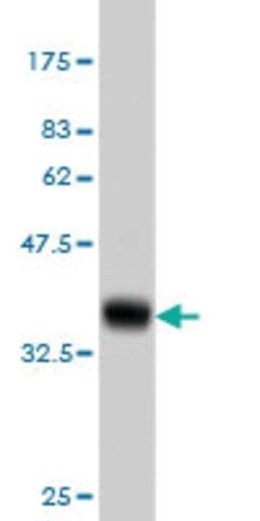 ANTI-CACNB2 antibody produced in mouse