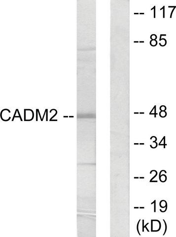 Anti-CADM2 antibody produced in rabbit
