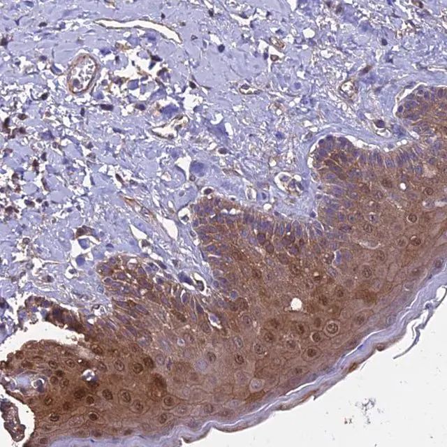 Anti-CALM1 antibody produced in rabbit