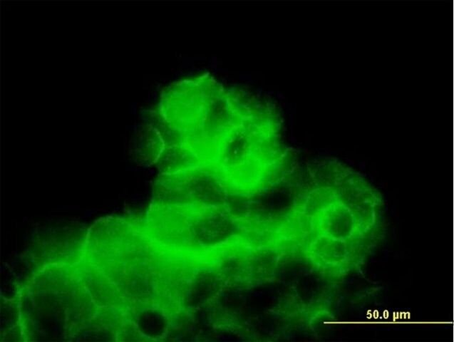 Anti-CALCR antibody produced in mouse