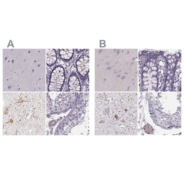 Anti-CALCR antibody produced in rabbit