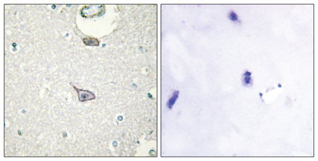 Anti-CADM4 antibody produced in rabbit
