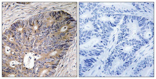 Anti-CAD antibody produced in rabbit