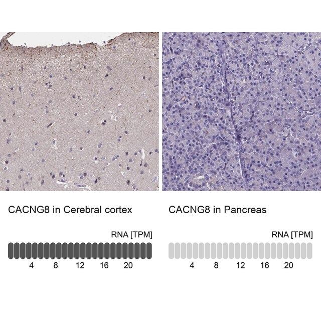 Anti-CACNG8 antibody produced in rabbit