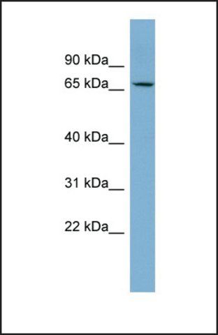 Anti-CACNB2 antibody produced in rabbit