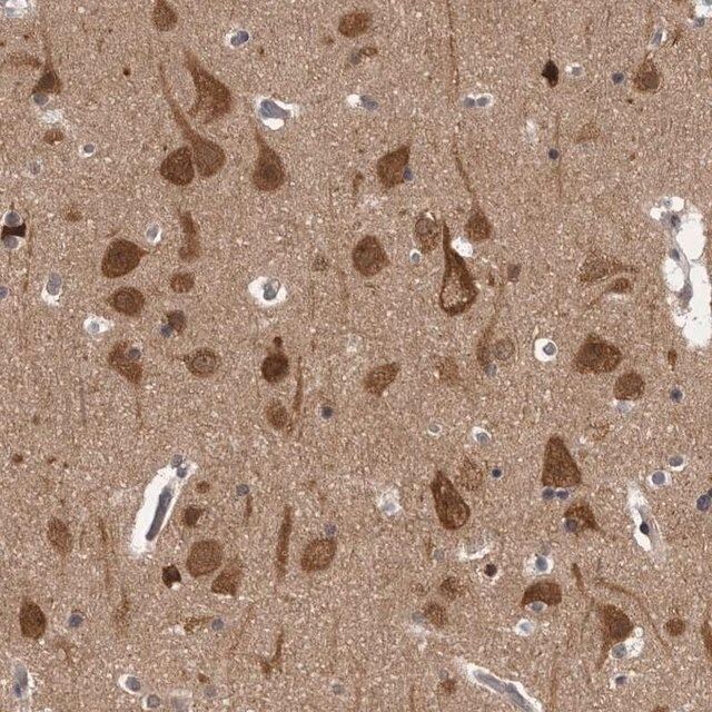 Anti-CACYBP antibody produced in rabbit