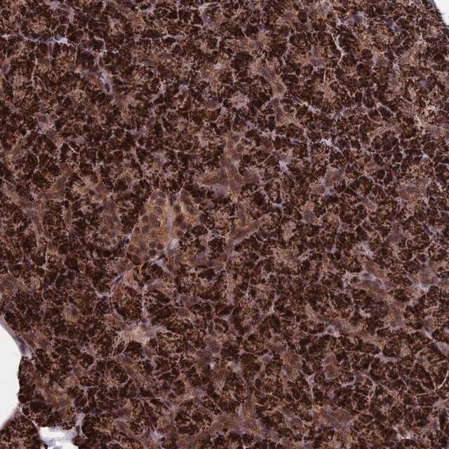 Anti-CACTIN antibody produced in rabbit