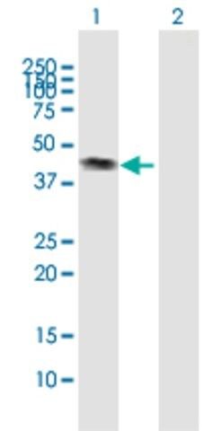 Anti-CALR3 antibody produced in mouse