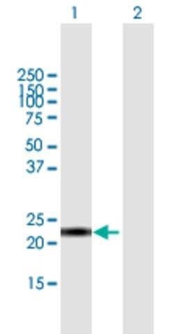 Anti-CALML6 antibody produced in mouse