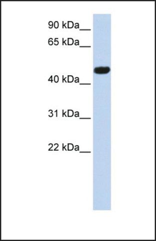 Anti-CACNB4 antibody produced in rabbit
