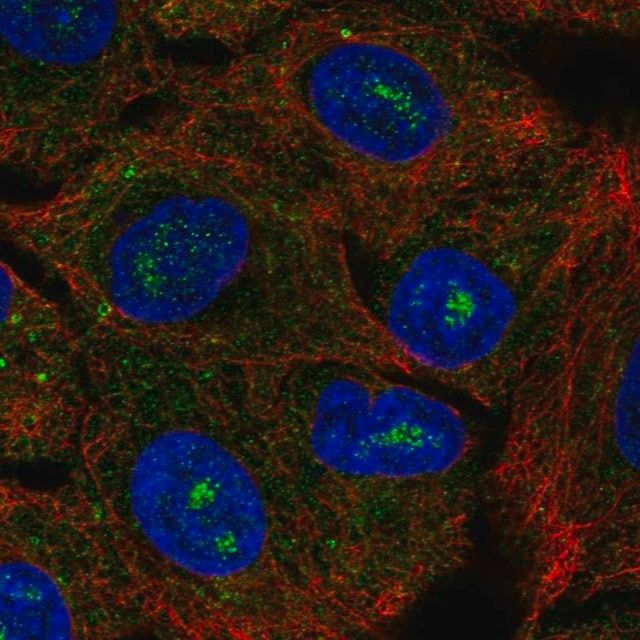 Anti-CACNG6 antibody produced in rabbit