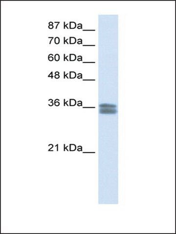 Anti-CACNG4 antibody produced in rabbit