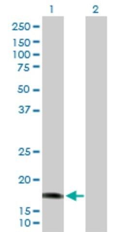 Anti-CALML5 antibody produced in rabbit