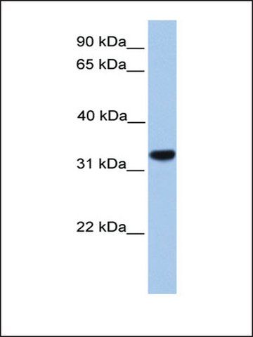 Anti-CACNG4 antibody produced in rabbit