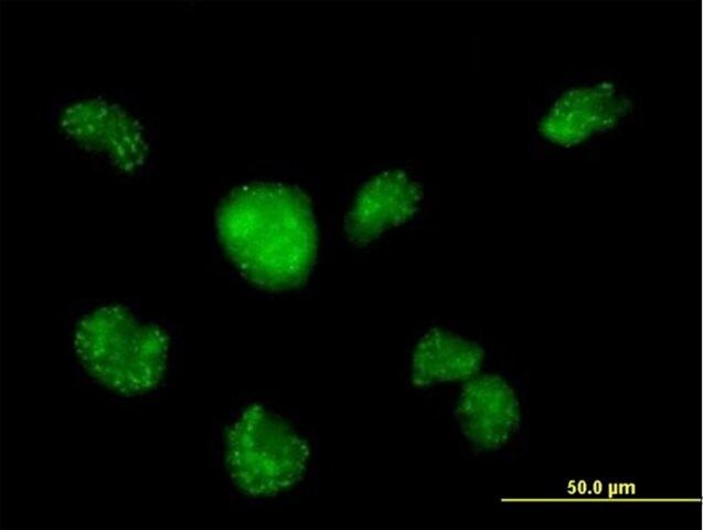 Anti-CALML3 antibody produced in mouse