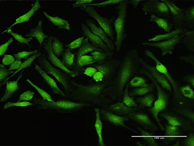 Anti-CALCOCO1 antibody produced in mouse