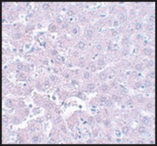 Anti-CALHM1 antibody produced in rabbit