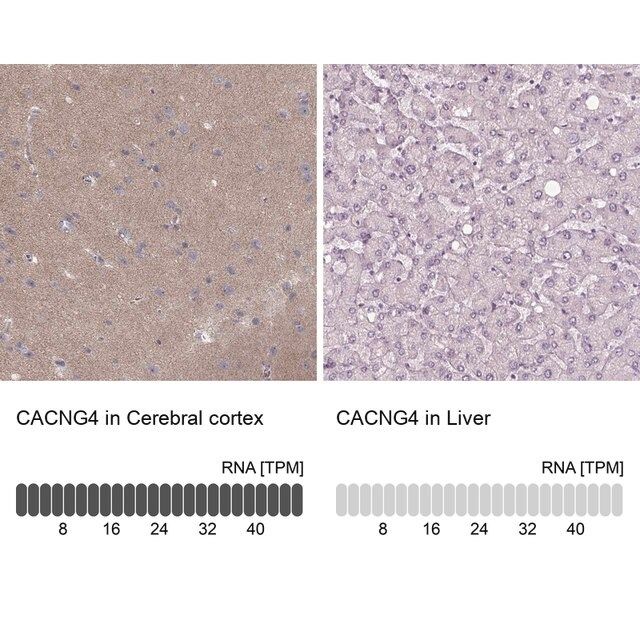 Anti-CACNG4 antibody produced in rabbit