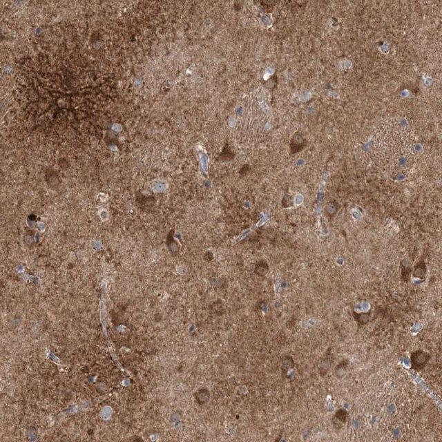Anti-CALN1 antibody produced in rabbit