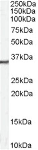 Anti-Calretinin antibody produced in goat